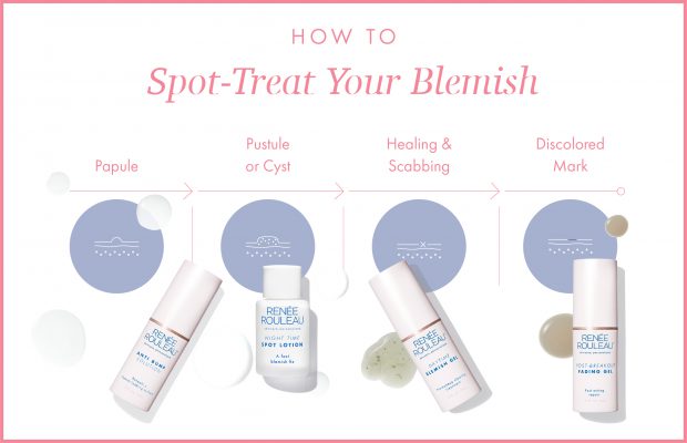 stages of a blemish and best spot treatment for each